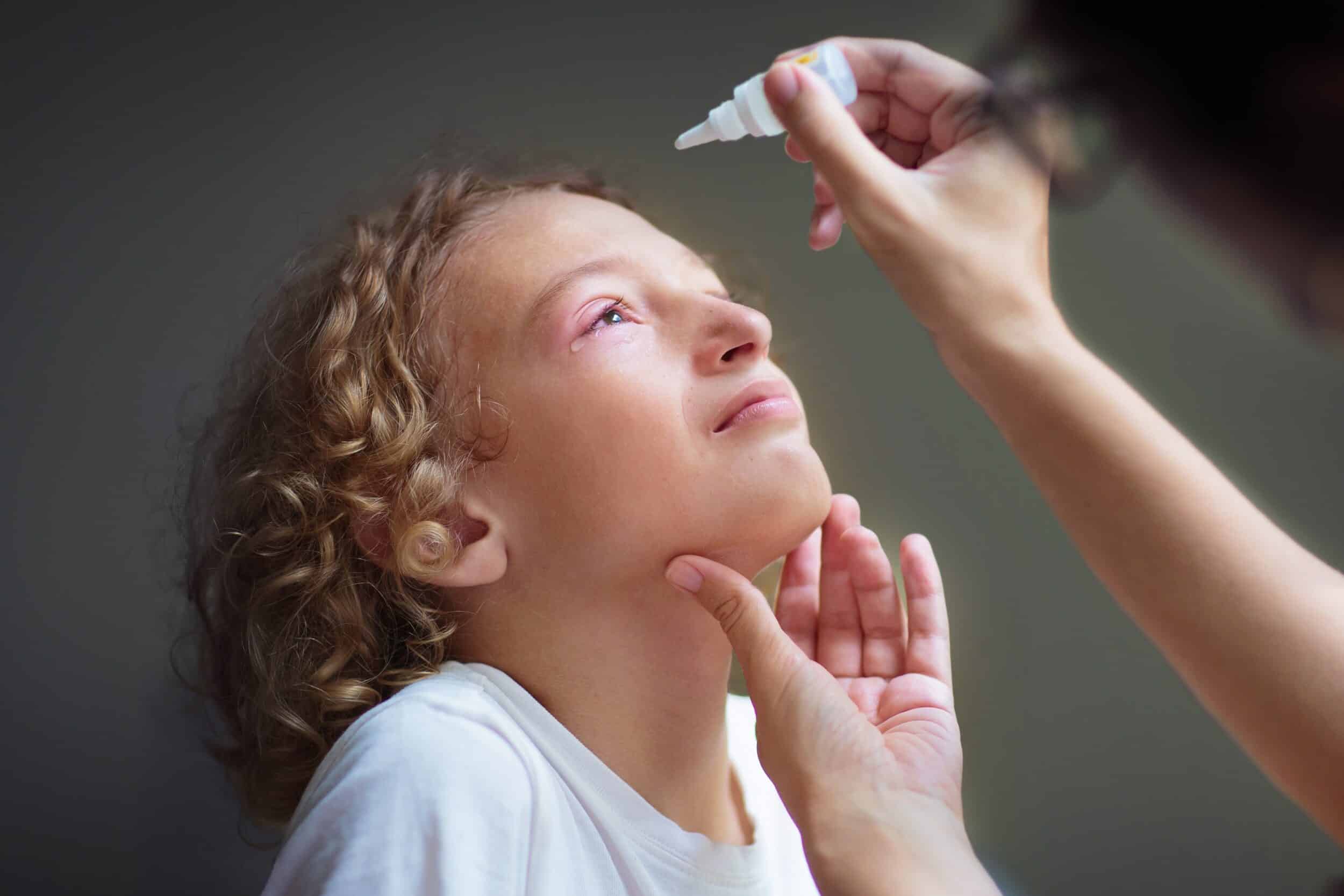 Child,With,Swollen,Pink,Eye.,Eyes,Infection,And,Pollen,Allergy. Conjunctivitis Treatment Dallas TX
