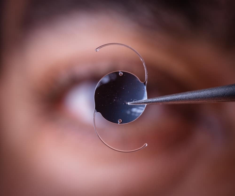Close up of a provider holding up an IOL in front of a patient's eye, discussing their lens options. Close up of a provider holding up an IOL in front of a patient's eye, discussing their lens options.